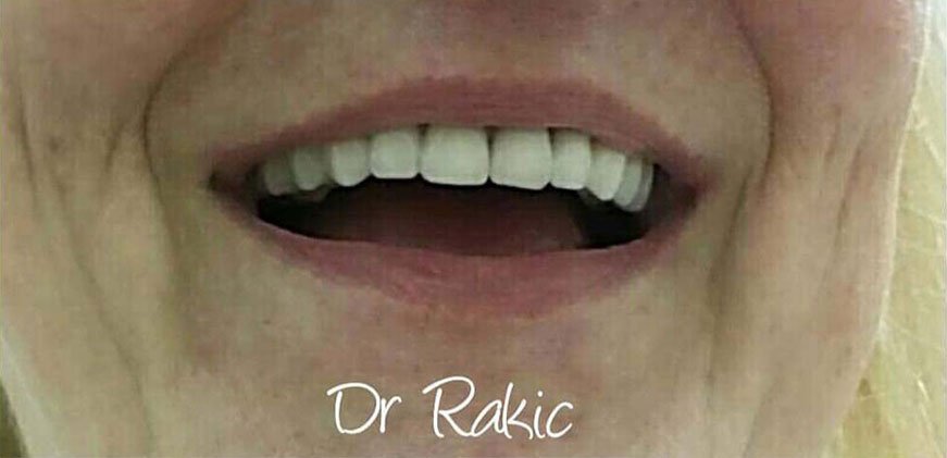 Stomatološka ordinacija Dr Rakić