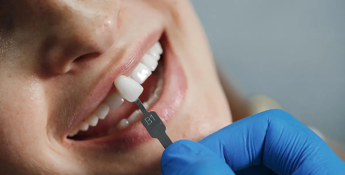 Sve što Trebate Znati o Zubnim Implantatima: Kompletan Vodič