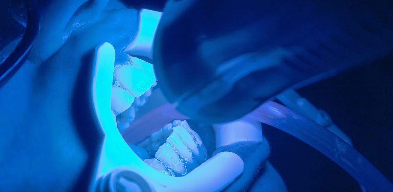 Dentalni turizam u Novom Sadu – od 3D snimka do novog osmeha